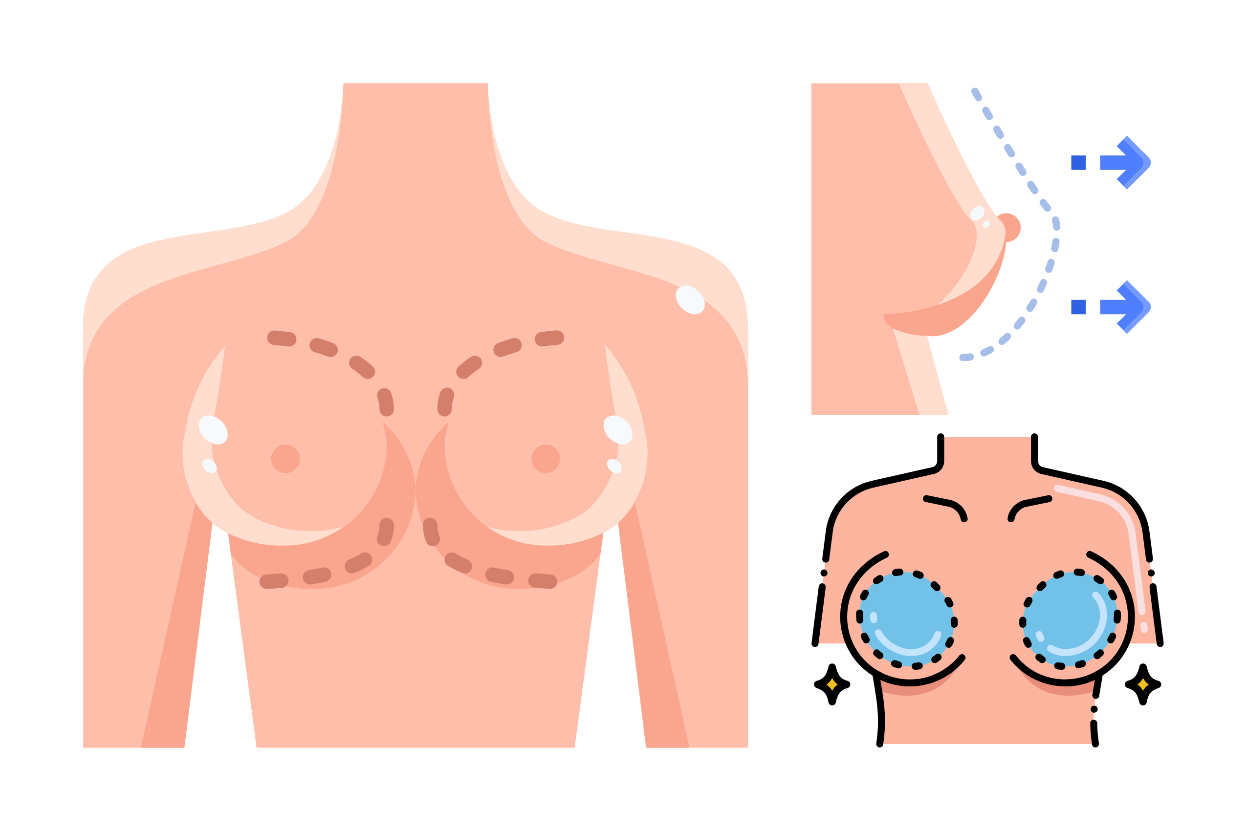 10 Common Myths About Breast Augmentation No One Will Tell You