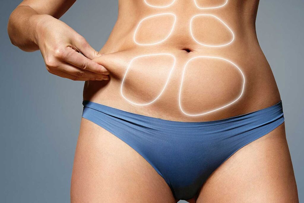 HD liposculpture in London, cosmetic surgery recovery, plastic surgeon London, liposculpture aftercare, body contouring London