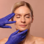 SMAS Facelift: Here’s Why It’s Ideal for Moderate Facial Sagging